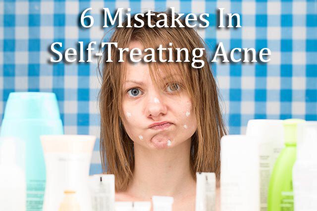 self treating acne