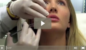 juvederm-injection-web