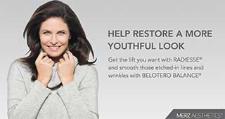 Belotero Lower Face Wrinkle Correction