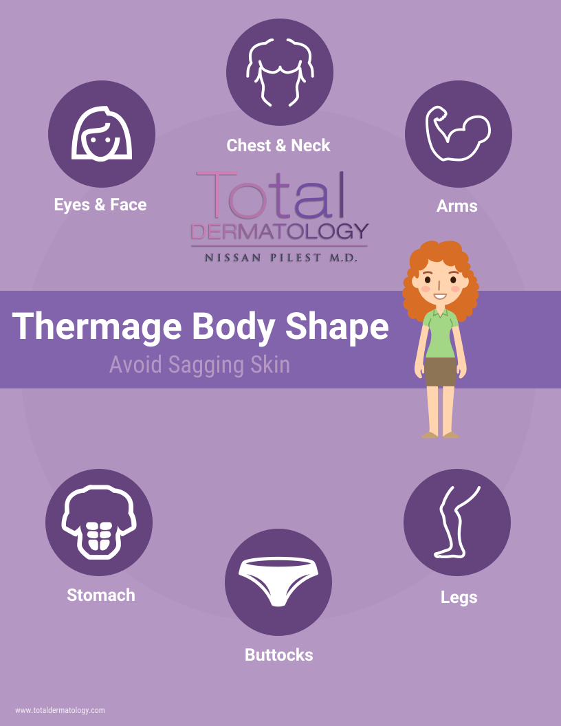 thermage infograph