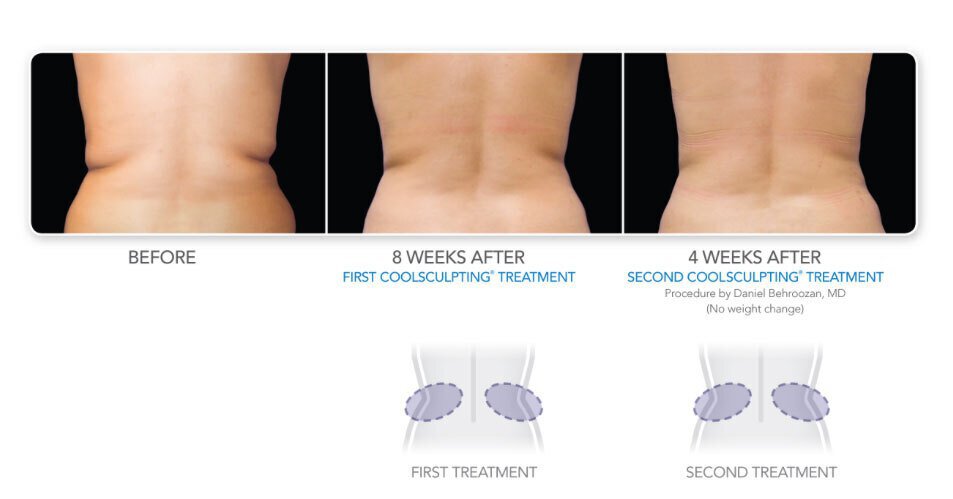 Treatment to Transform before and after