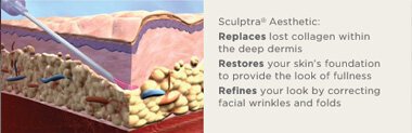 sculptra-in-action