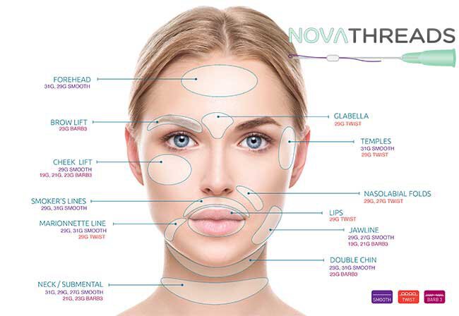 Thread Lifts Contact Request Irvine | Total Dermatology