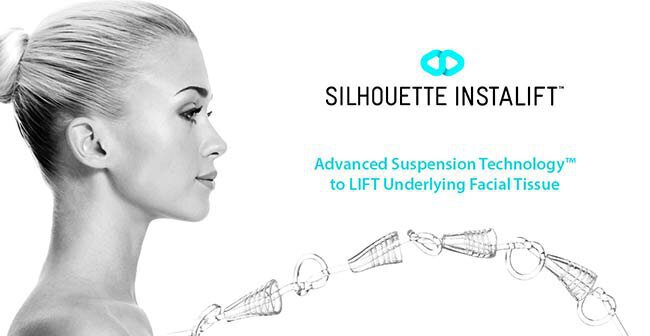 silhouette instalift suture