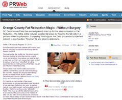 Orange County Fat Reduction – Without Surgery