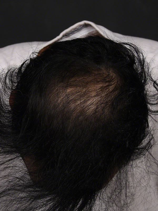 Anti Aging Before & After Image